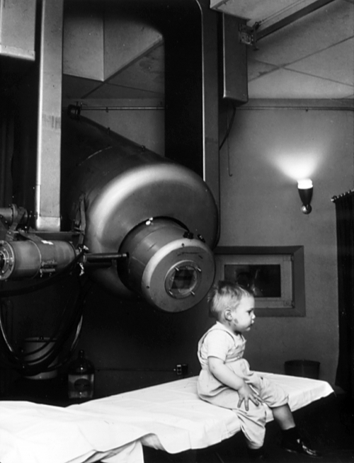 External Beam Radio Therapy