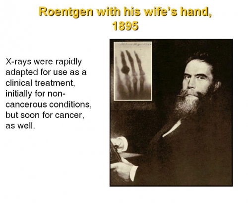 Roentgen With his wife's Hand,1895